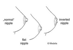 Flat Nipple